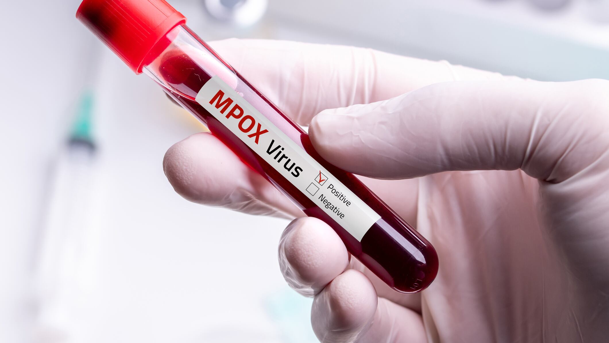 Mpox en México: así han avanzado los casos; ya hay registros en CDMX y Edomex