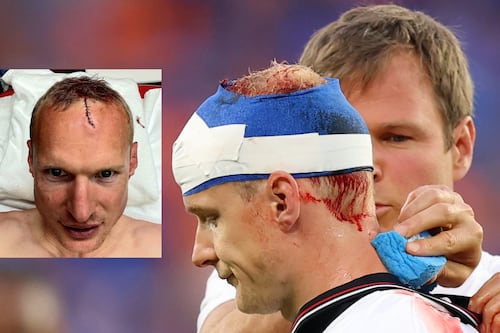 FOTO: Así quedó la cabeza de un jugador del Frankfurt tras brutal herida