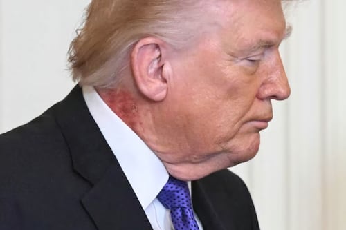 Médico de Donald Trump explica la razón del sarpullido en el cuello del presidente
