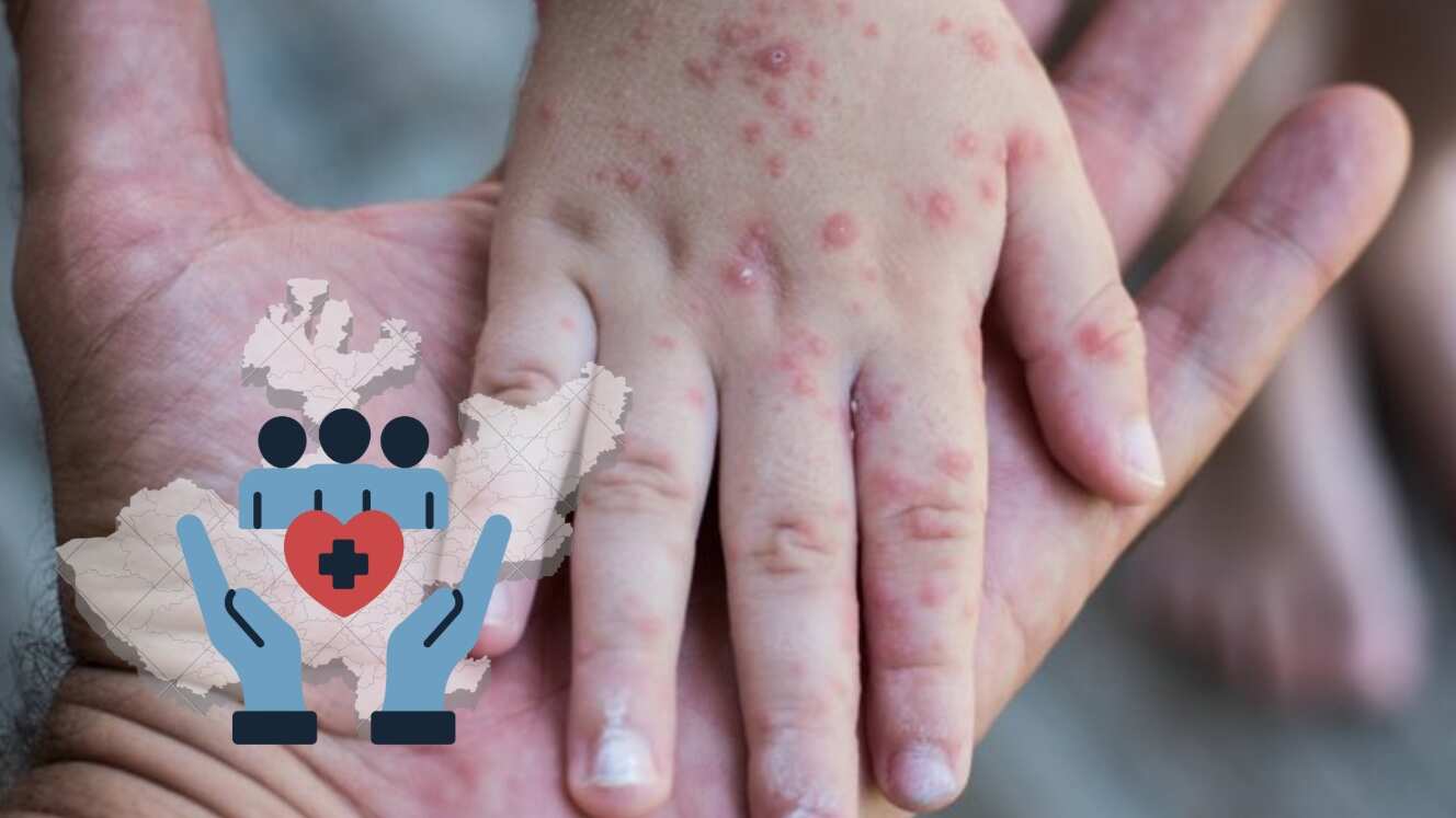 (IMAGEN ILUSTRATIVA) ESPECIAL/ CANVA