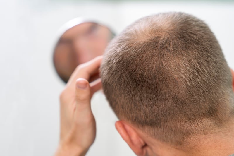 Los expertos en dermatología de Dove explican los factores detrás de la caída capilar y los últimos avances que integran ingredientes del skincare al cuidado del cuero cabelludo