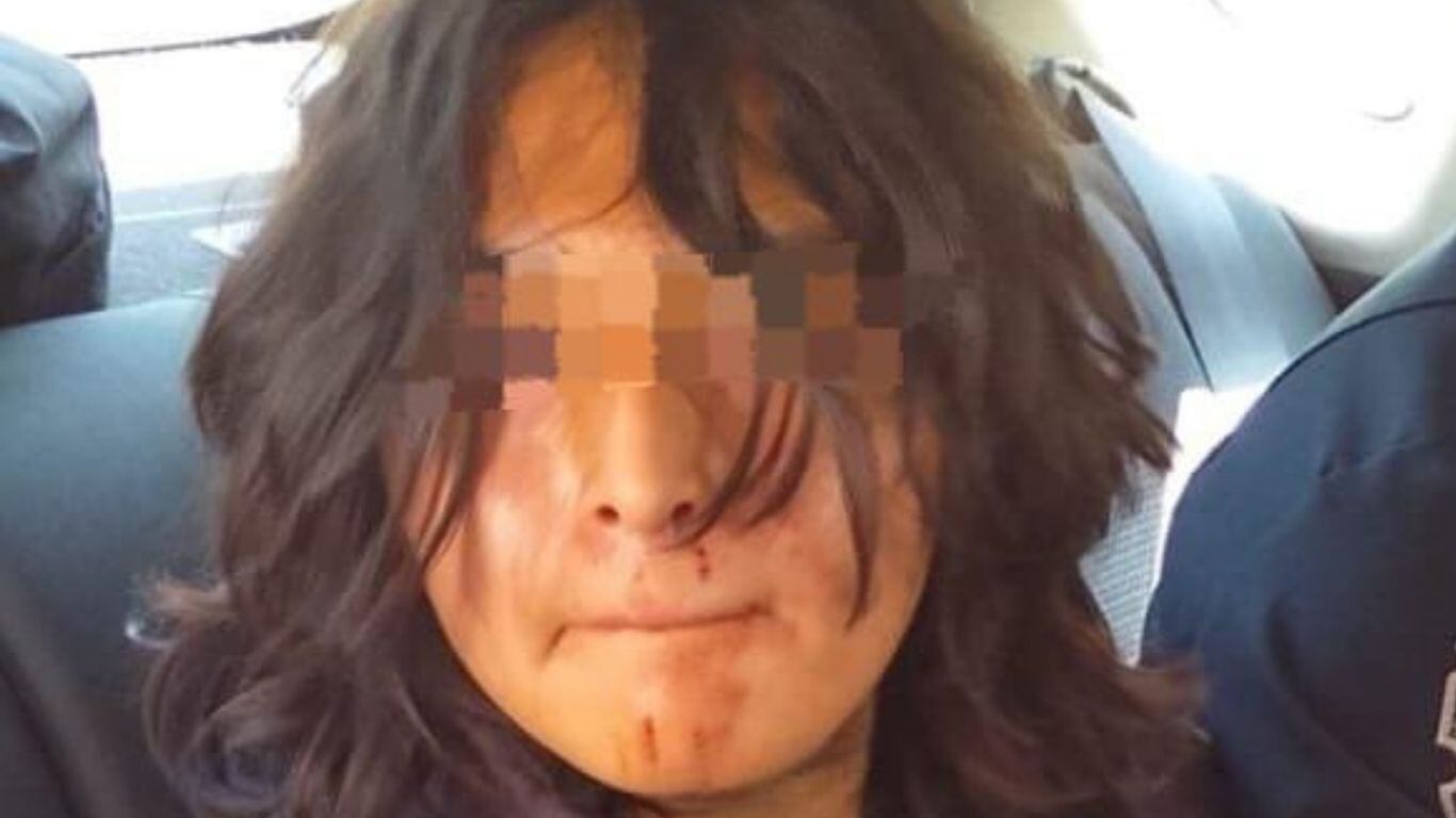 Alumno apuñala a maestro en CCH Naucalpan