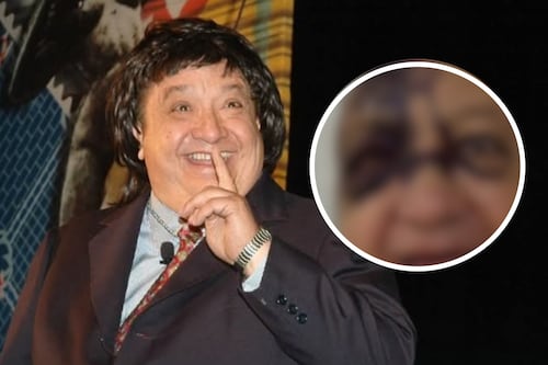 ¿Qué le pasó a Luis de Alba? El actor aparece con el rostro morado y aclara cómo se encuentra