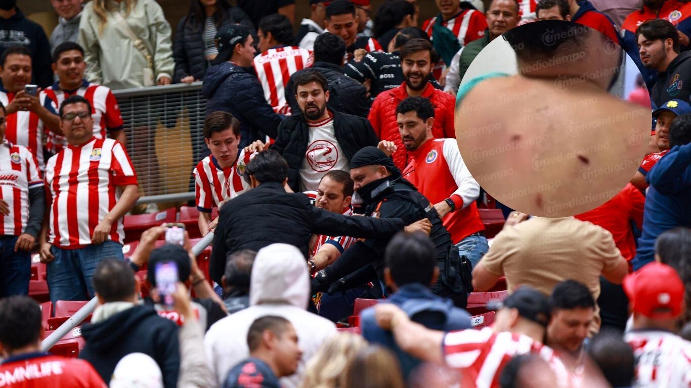 Aficionado del Atlas apuñalado