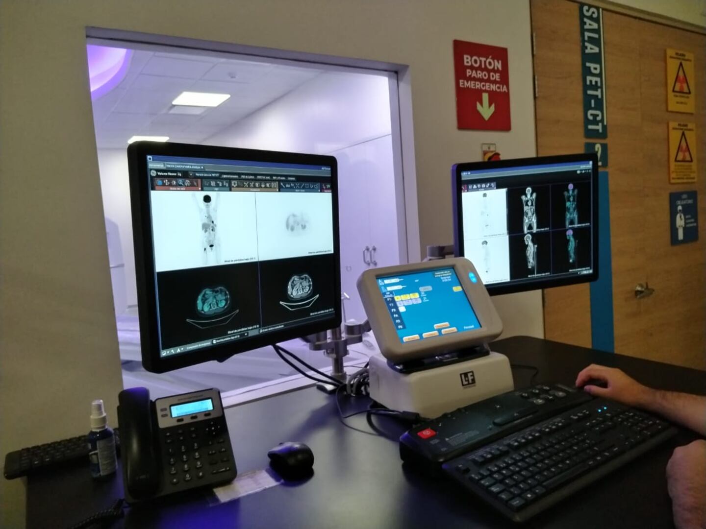 Centro Especializado PET-CT: detectarán cáncer, a precios accesibles ...