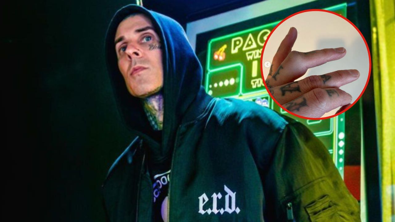 Travis Barker se someterá a una cirugía de emergencia