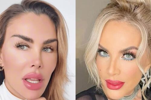 Lorena Herrera arremete contra Ninel Conde tras promover el uso de cirugías estéticas
