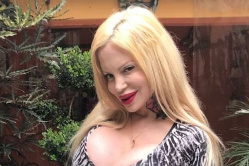 Sabrina Sabrok perdió parte de la movilidad de su rostro por abusar del bótox