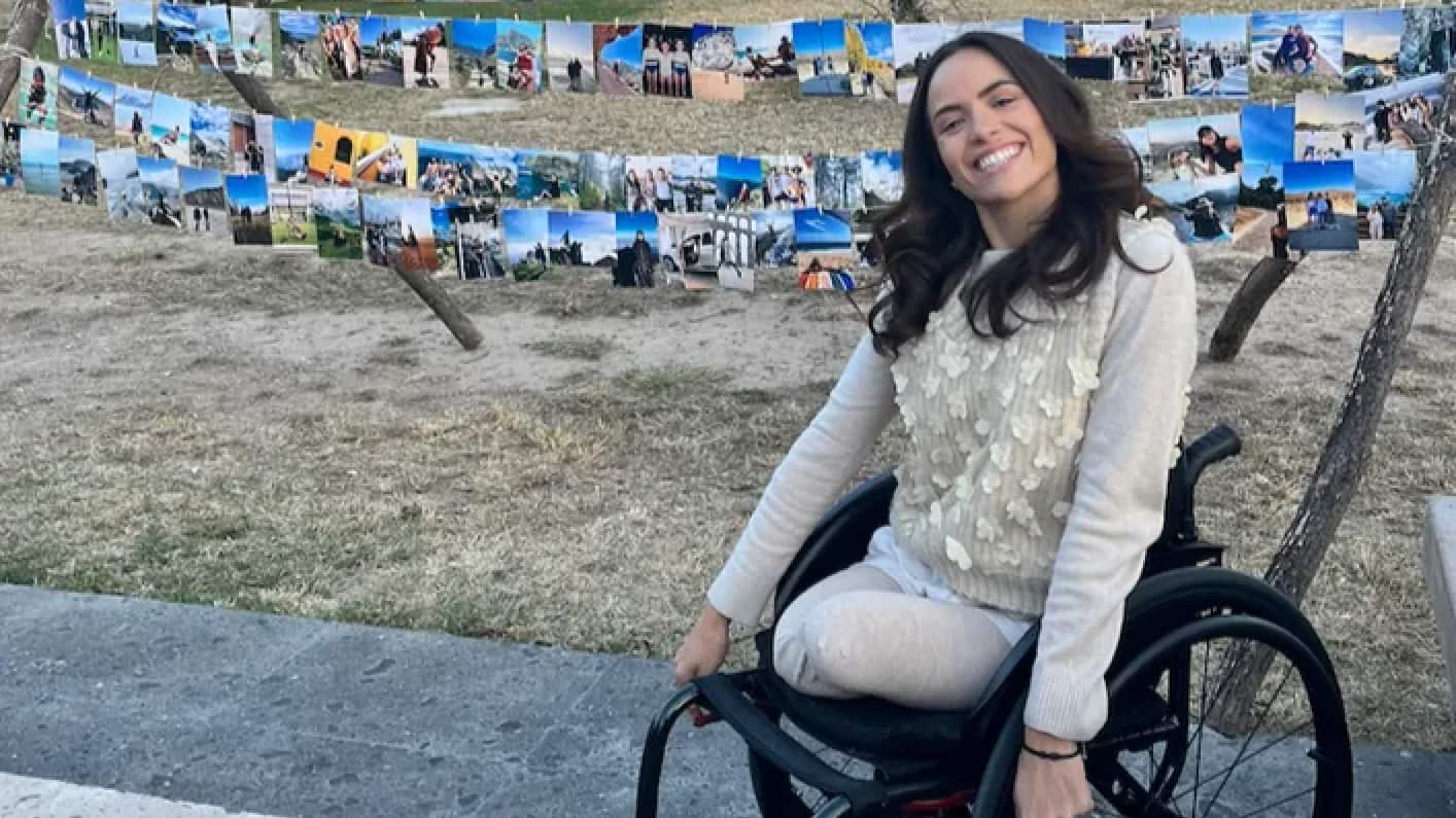 Las prótesis que necesita cuestan más de 7 millones de pesos.