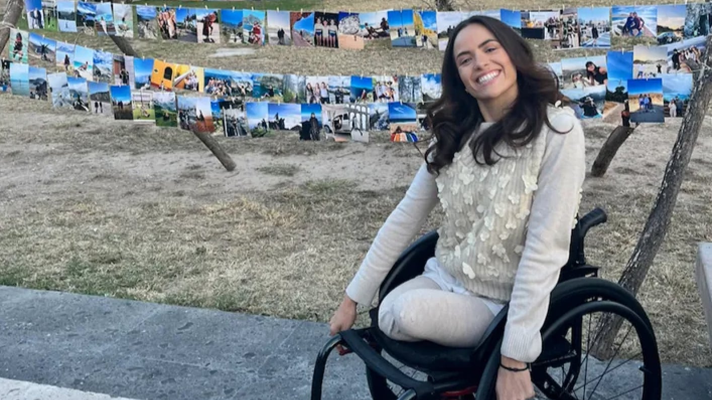 Las prótesis que necesita cuestan más de 7 millones de pesos.