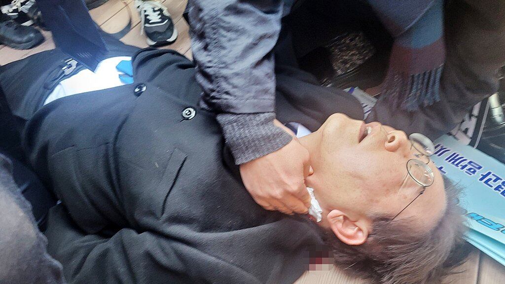 Fue atacado con un cuchillo de entre 20 y 30 cm. (Especial)