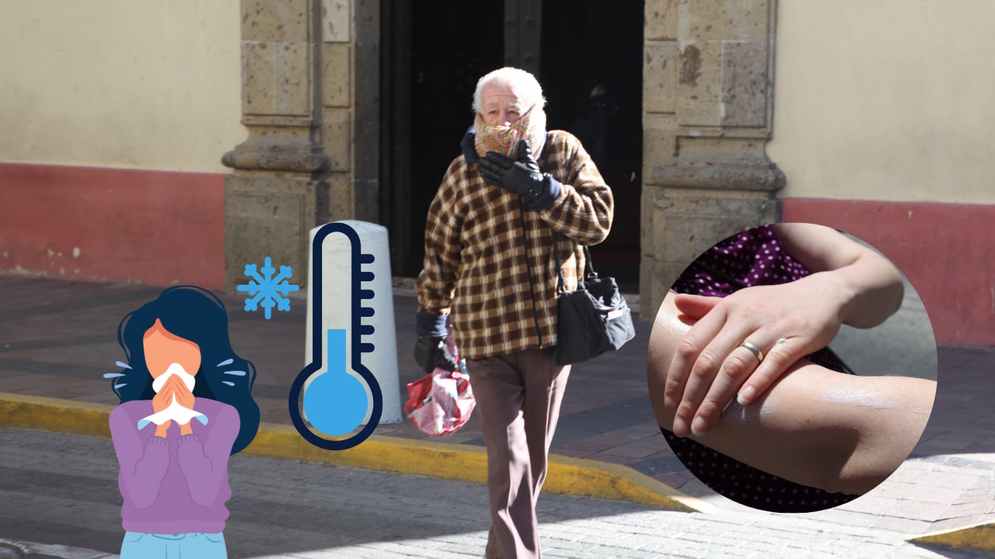 Durante el invierno incrementan los padecimientos cutáneos en Jalisco. (IMAGEN ILUSTRATIVA) ESPECIAL/ GOBIERNO DE JALISCO/ CANVA