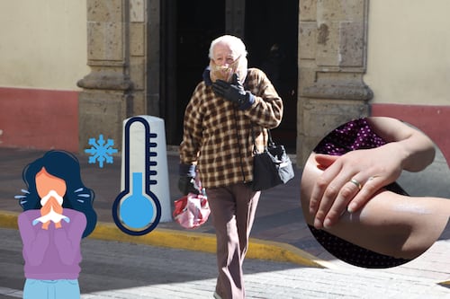 La SSJ reporta 510 casos de dermatitis atópica durante este invierno 2025