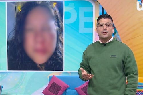 Integrante de ‘Venga la alegría’ que fue golpeada, ingresará al quirófano; tiene fractura en pómulo y ojo