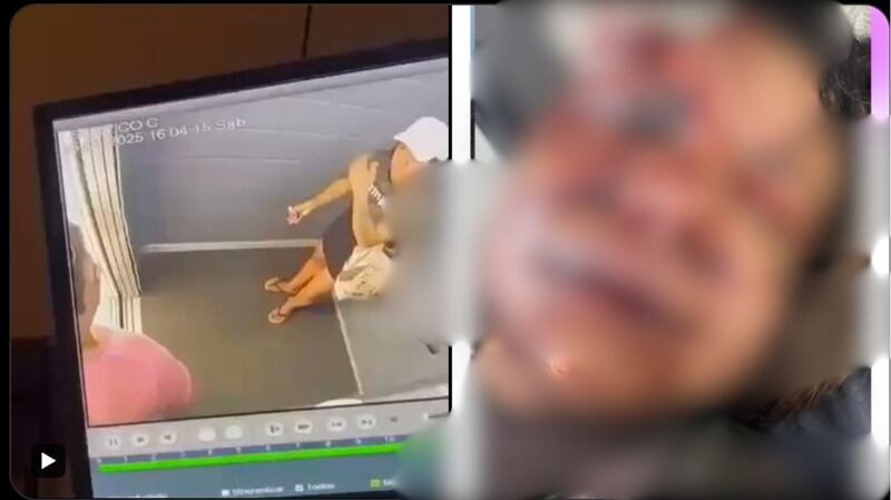 Golpiza a su novia