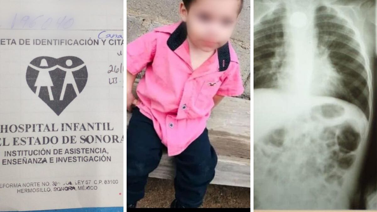 Bebé come pila y esta le explota en el estómago; familia pide ayuda