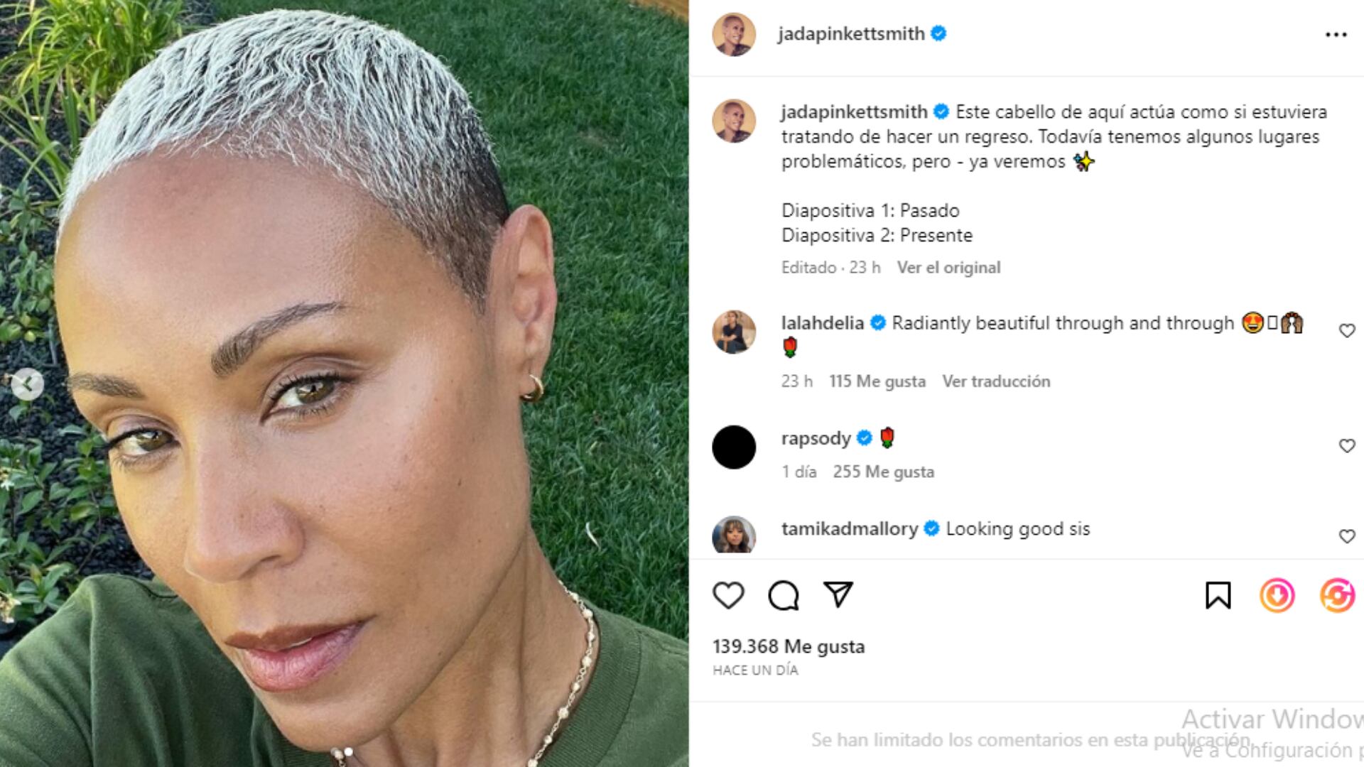 La actriz Jada Pinkett Smith compartió con sus fans los avances que ha tenido en la batalla contra la alopecia.