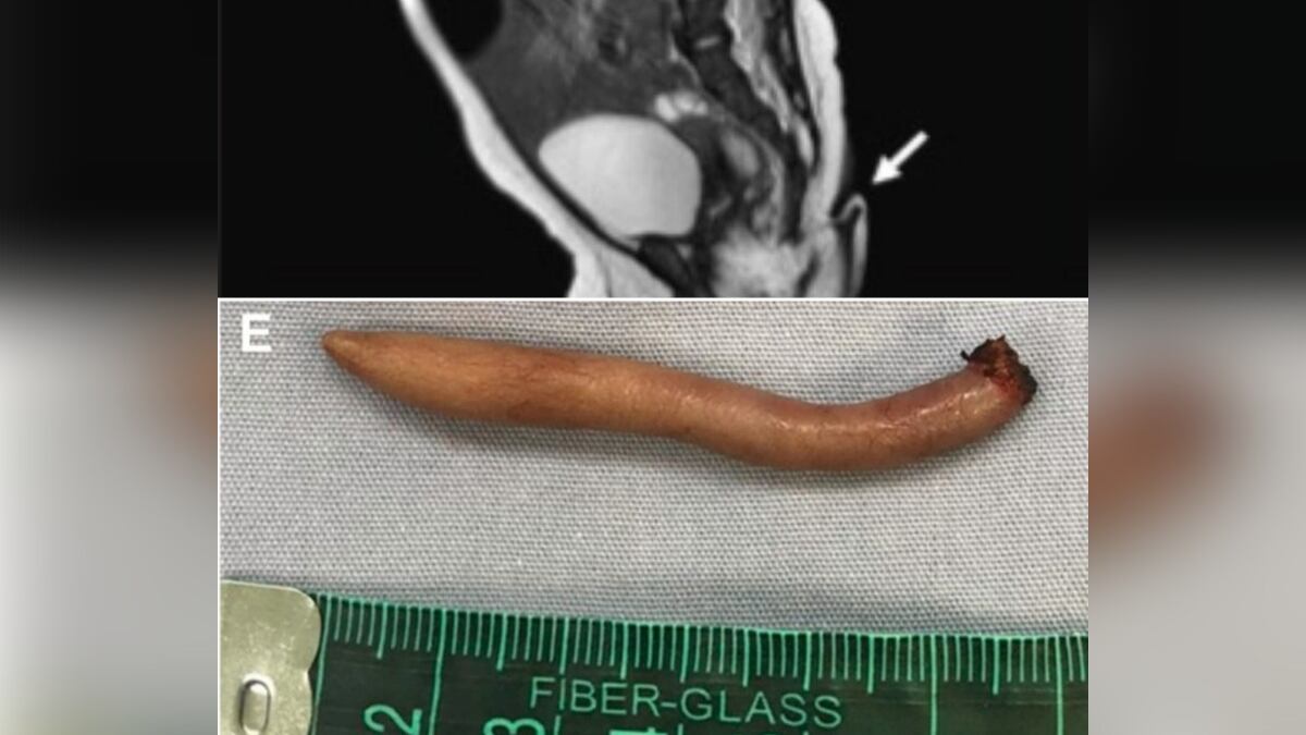 Se trata de una condición sumamente rara en el tema de salud.