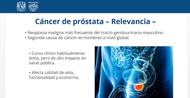 Cáncer de próstata: vergüenza evita que hombres acudan a tacto rectal para detección