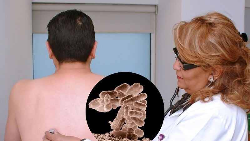 ¿Cuántos casos de tuberculosis hay en México en lo que va de 2025?