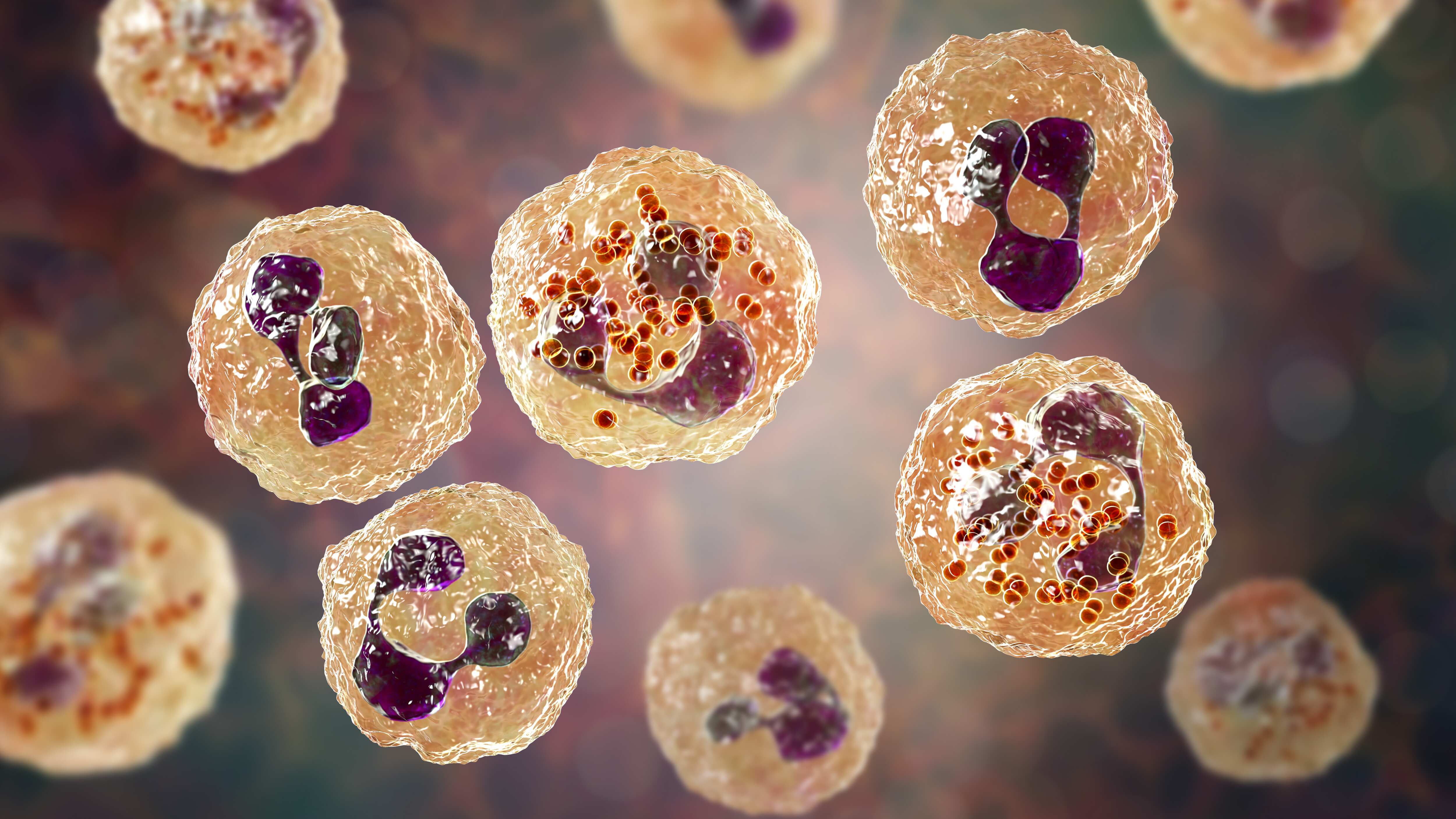 Meningitis aséptica