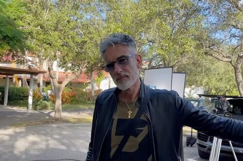 Miguel Varoni y su transformación luego de pasar por el quirófano