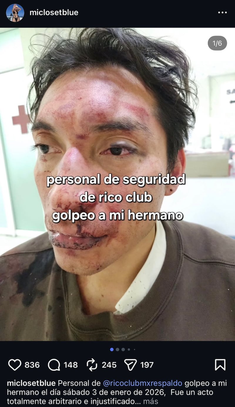 Denuncian golpiza en el Rico Club