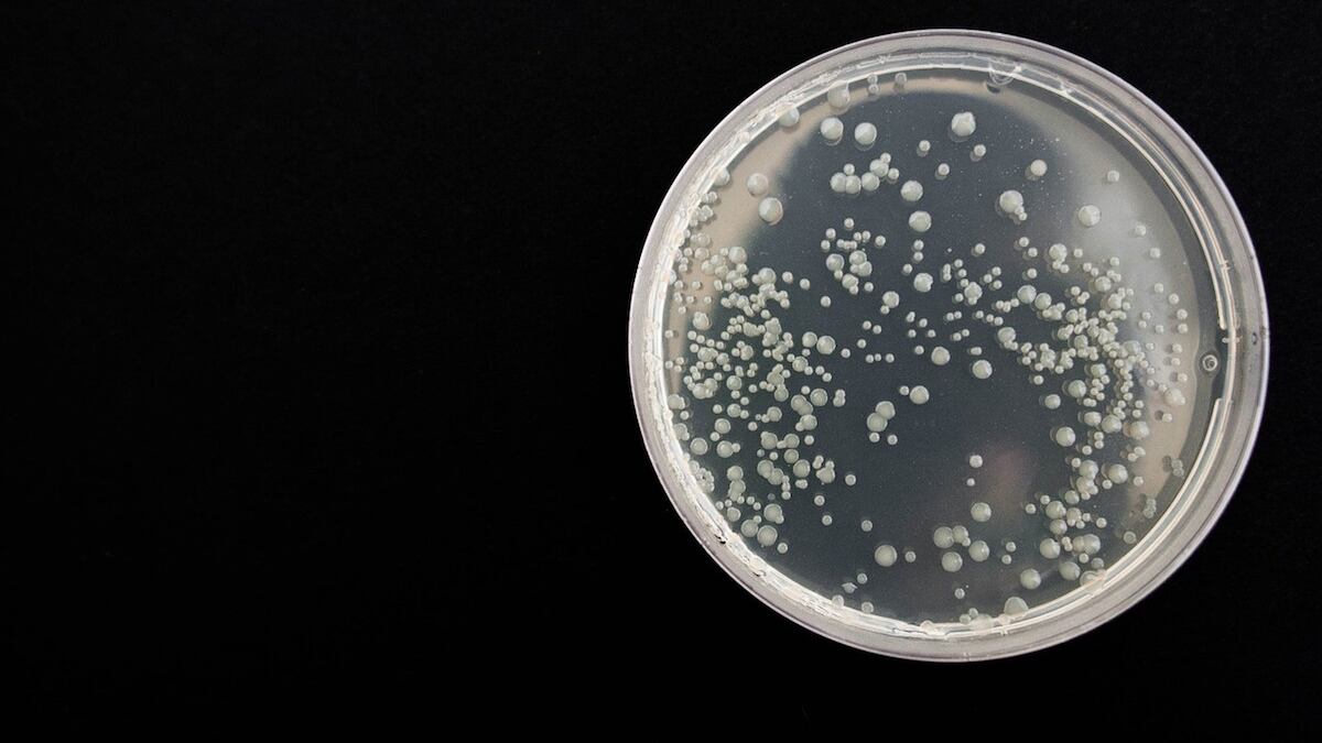 Si no es atendida puede generar diferentes daños. (Pixabay)