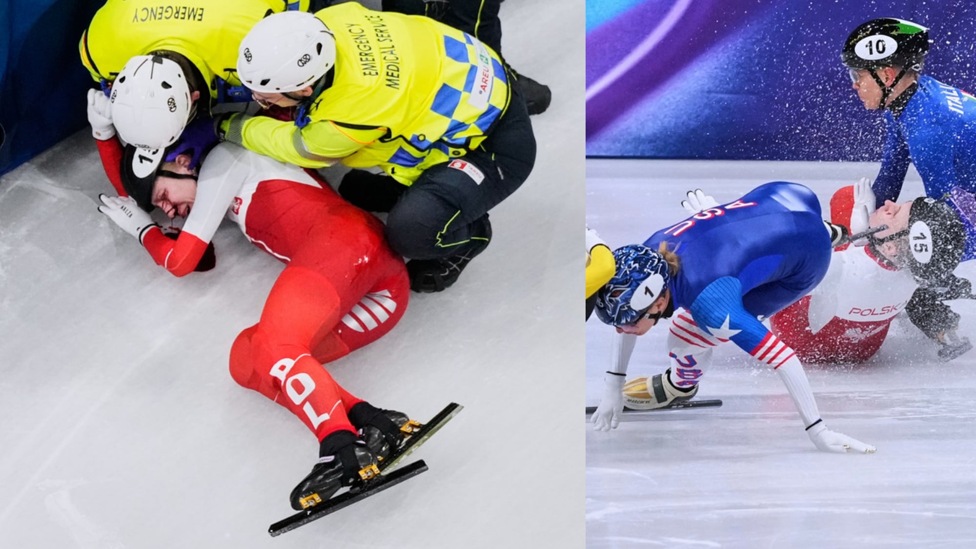 Kamila Sellier accidente en el rostro