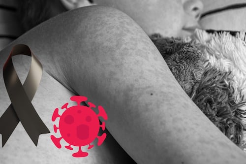 Bebé de 11 meses fallece por sarampión en Arandas; no contaba con vacunas