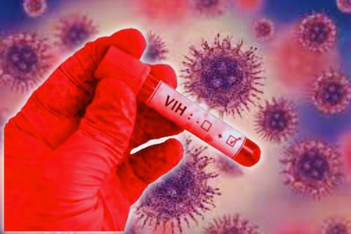 ¡Esperanza de vida! Científicos consiguen fórmula para eliminar VIH de las células
