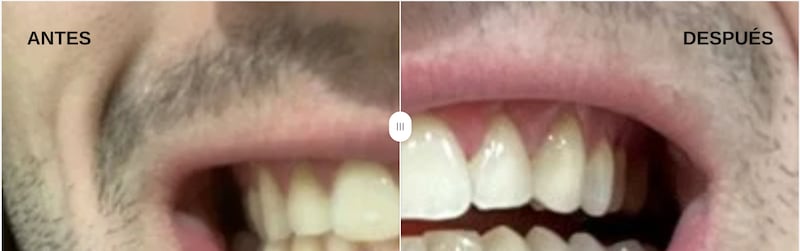 Cepillado de dientes