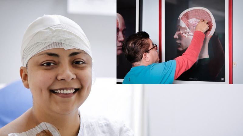 Retiran tumor cerebral a paciente que permaneció despierta en operación