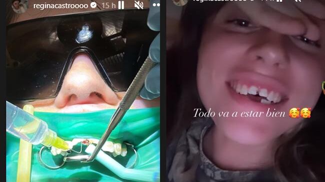 Regina Castro accidente dientes