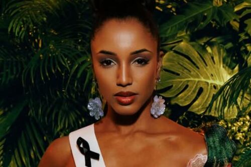 Miss Jamaica Universo 2025, reaparece en redes tras grave accidente que la llevó a terapia intensiva