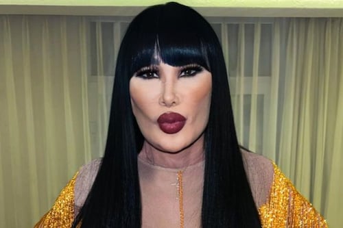 ¿Quedará como antes? Lyn May irá a Los Ángeles a que le arreglen el rostro