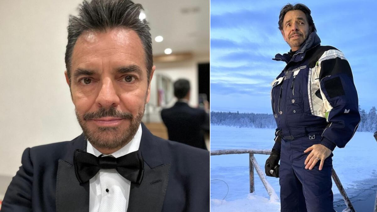 Eugenio Derbez preocupó por estas aparatosas marcas en la cara.