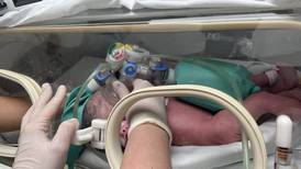 Siamesas llegan al mundo en el Hospital Materno Infantil, de Guadalupe